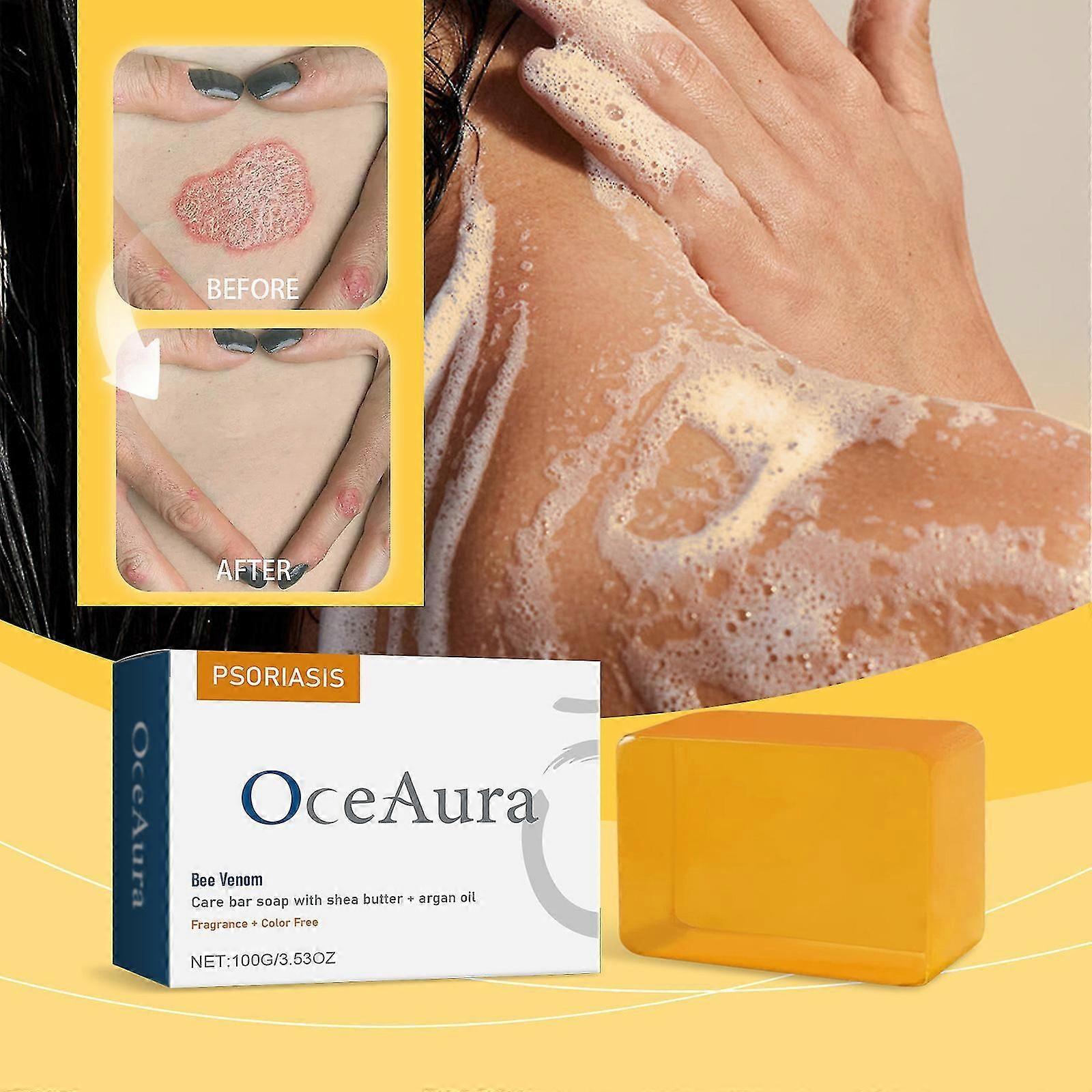 Bijengif Psoriasis Behandeling Zeep, Bijengif Psoriasis Care Bar Zeep, Bijengif Care Bar Zeep met Shea Boter & Arganolie