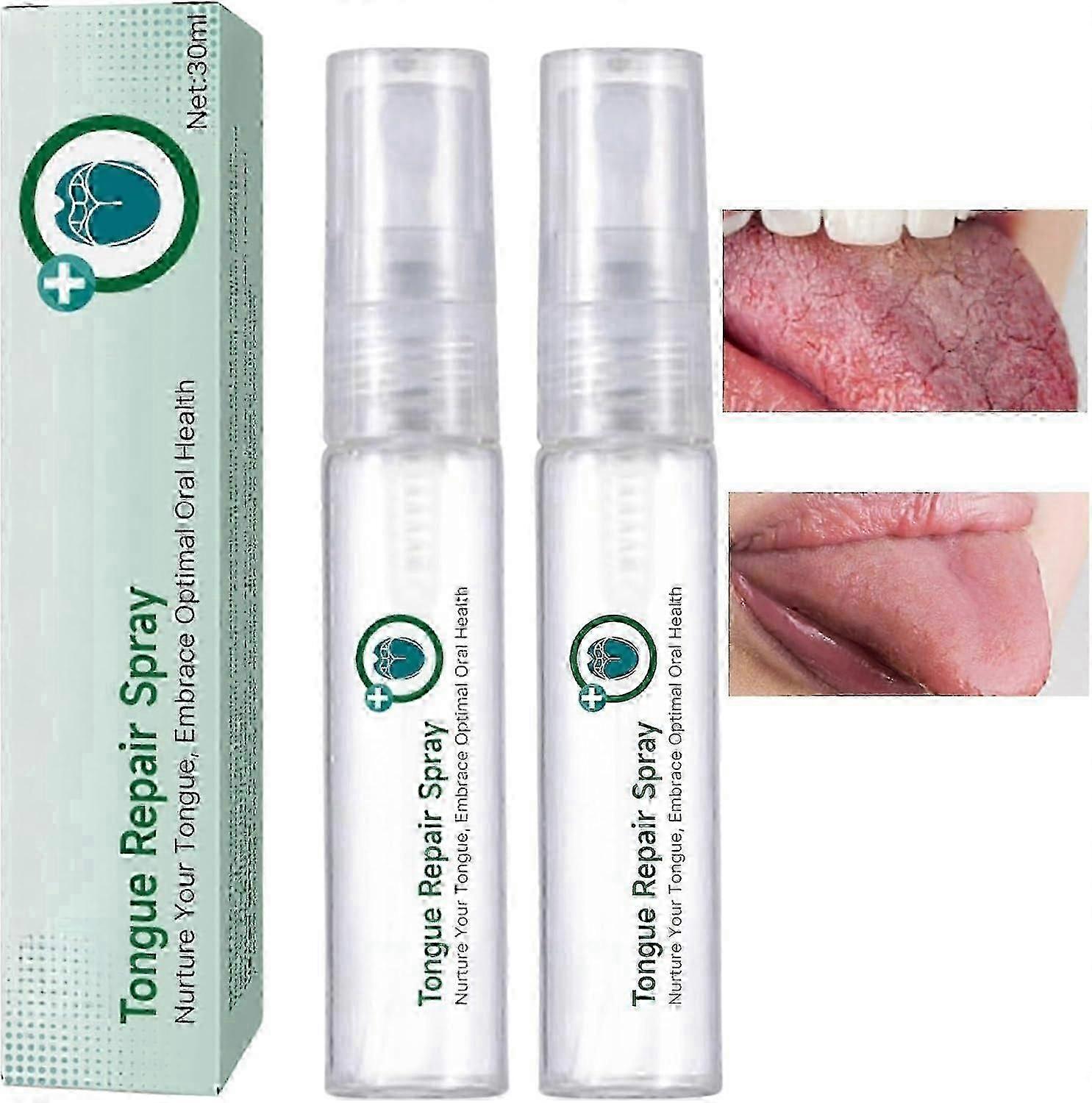 2Pcs Tongue Repair Spray, Mouth Odor Eliminator for Bad Breath, Fissured Tongue Relief Spray, Instant Dry Mouth Relief, Breath Freshener Spray