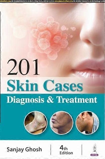 201 Skin Cases by Sanjay Ghosh Paperback Book