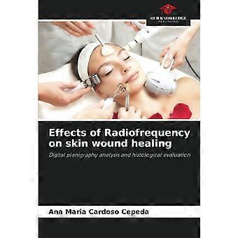 Effects of radiofrequency on skin wound healing digital planigraphy analysis and histological evaluation