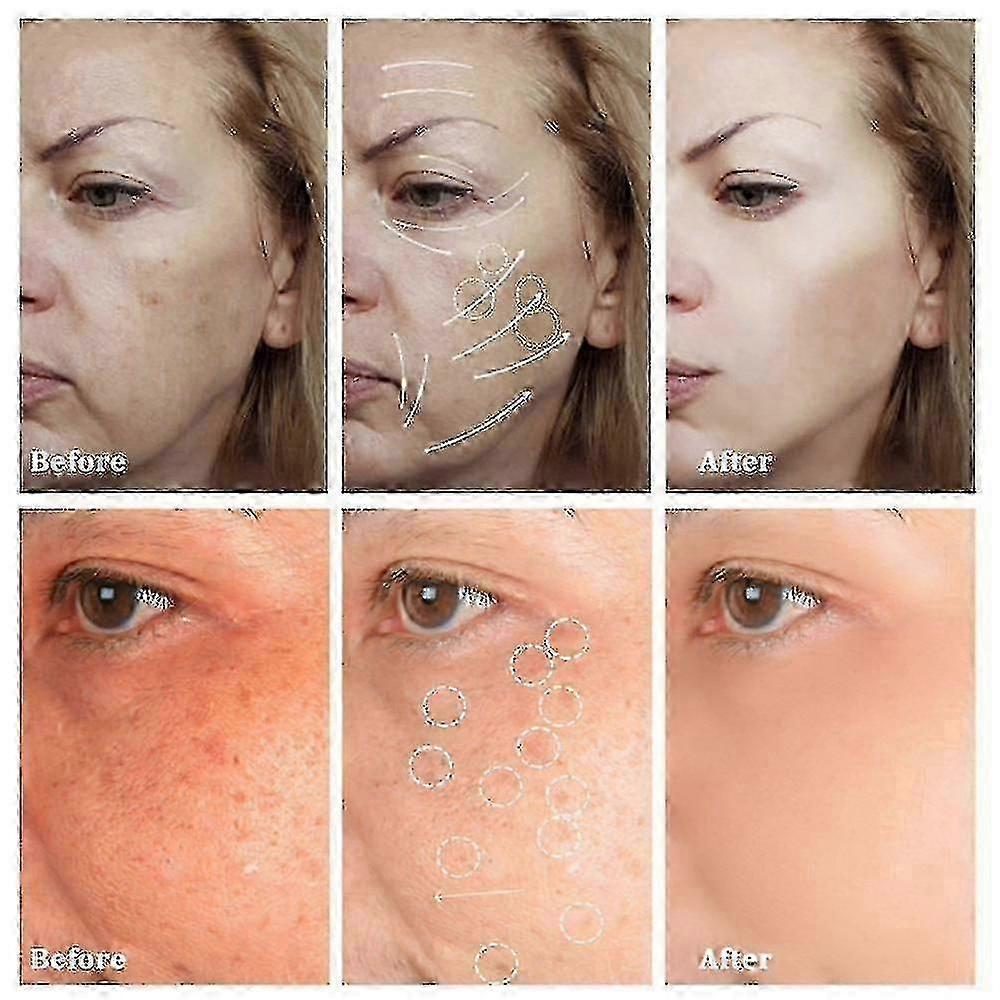 2025 קרם נמשים הלבנה חדש מסיר כתמים כהים אנטי אייג'ינג קוסמטיקה לטיפוח העור