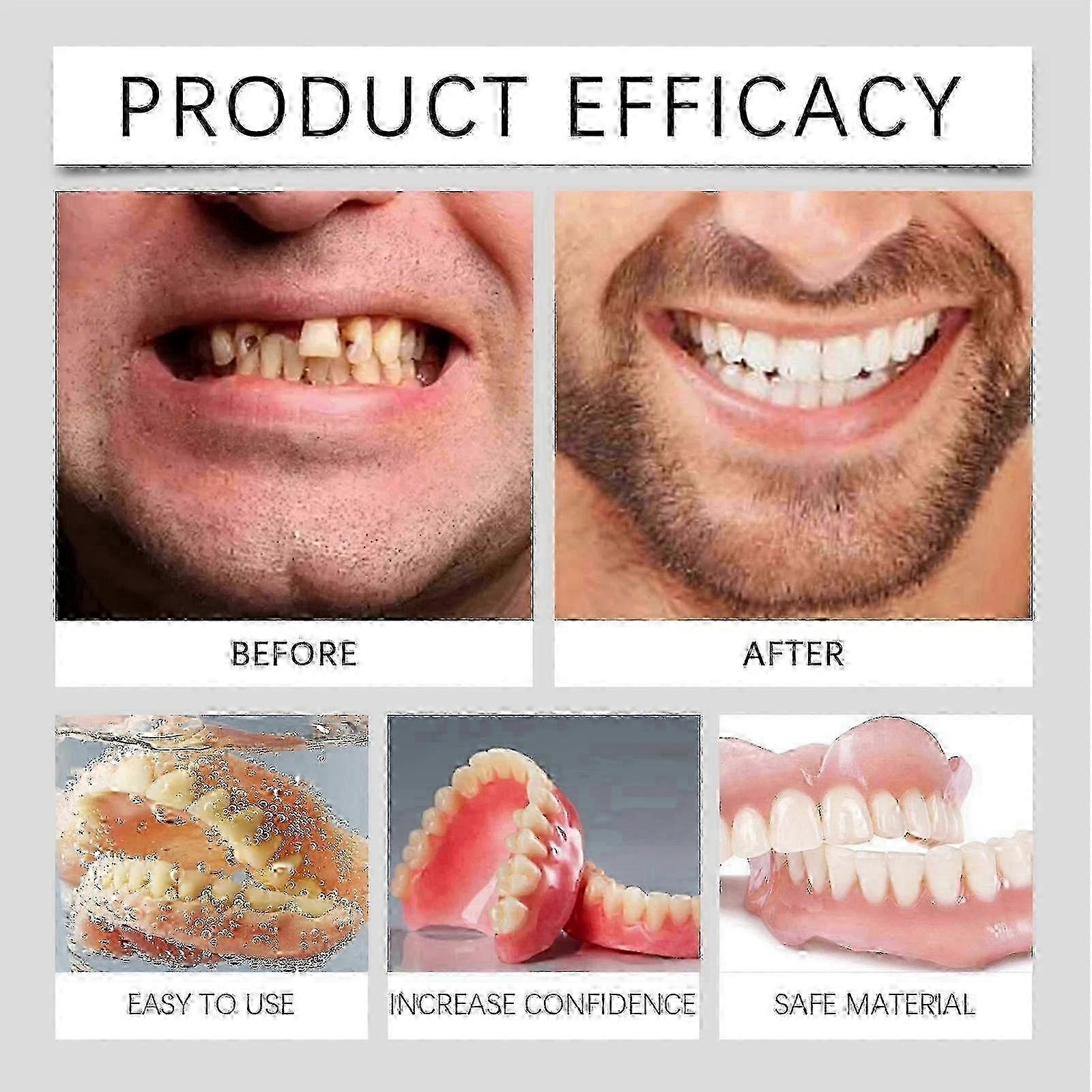 Natural Fit Full Denture Set Complete