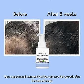 1-3pcs WishCare Hair Growth Serum Concentrate Hair for Men & Women 30ml