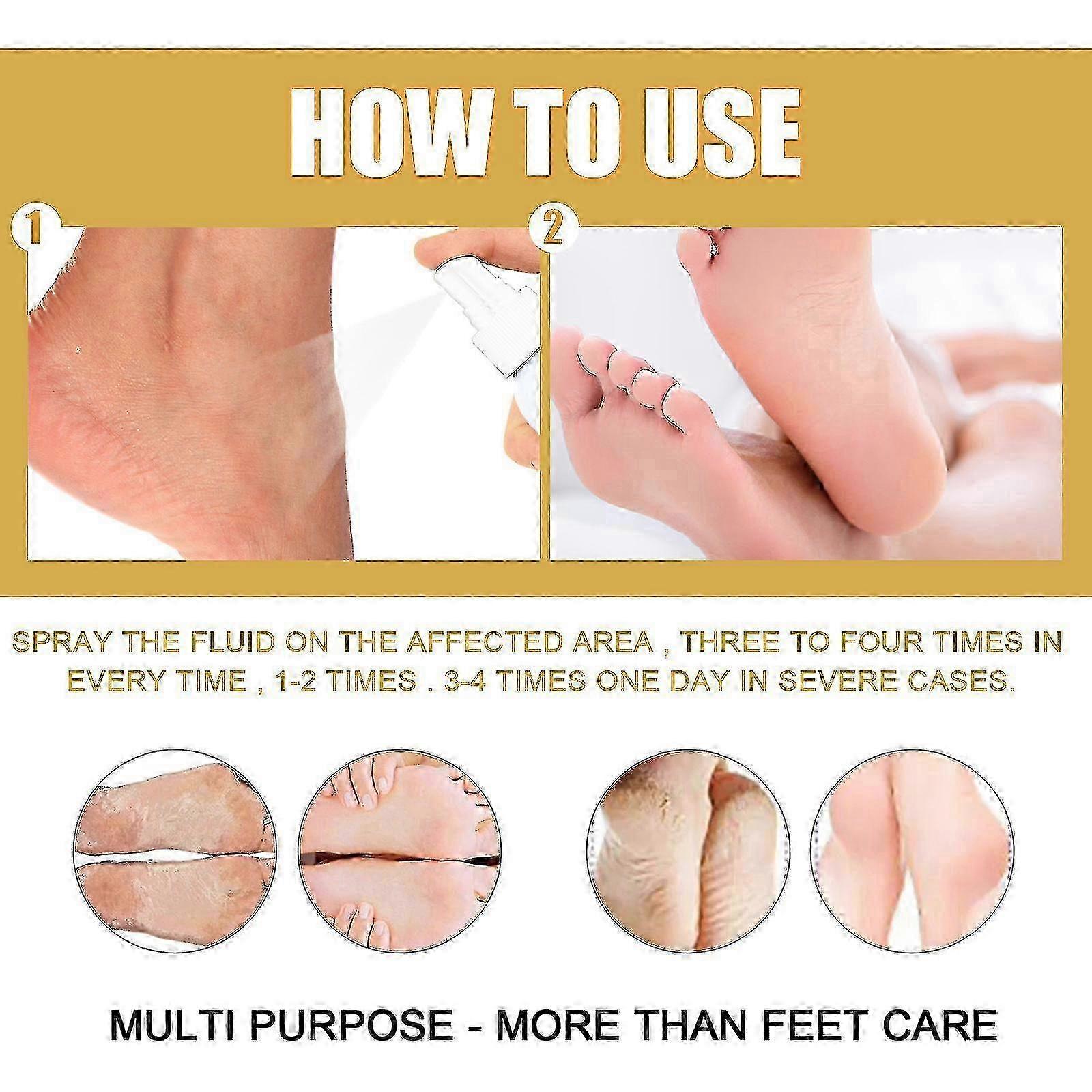 Eelhoe מסיר תרסיס לכף הרגל של ספורטאי, זיעה ברגל, מריח, כף רגל ספורטיבית, מסיר ריח, מפסיק גירוד, מרענן אנטיבקטריאלי, לחות לכף הרגל 