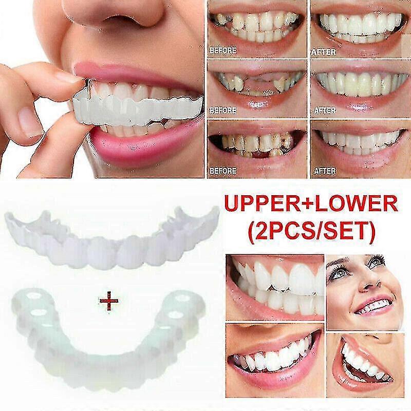 Snap On False Teeth Upper + Lower Dental Veneers Dentures Tooth Cover Set A