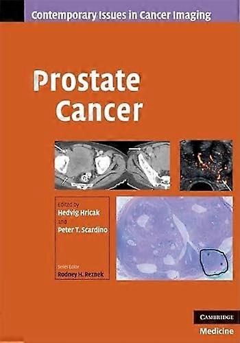 Prostate Cancer