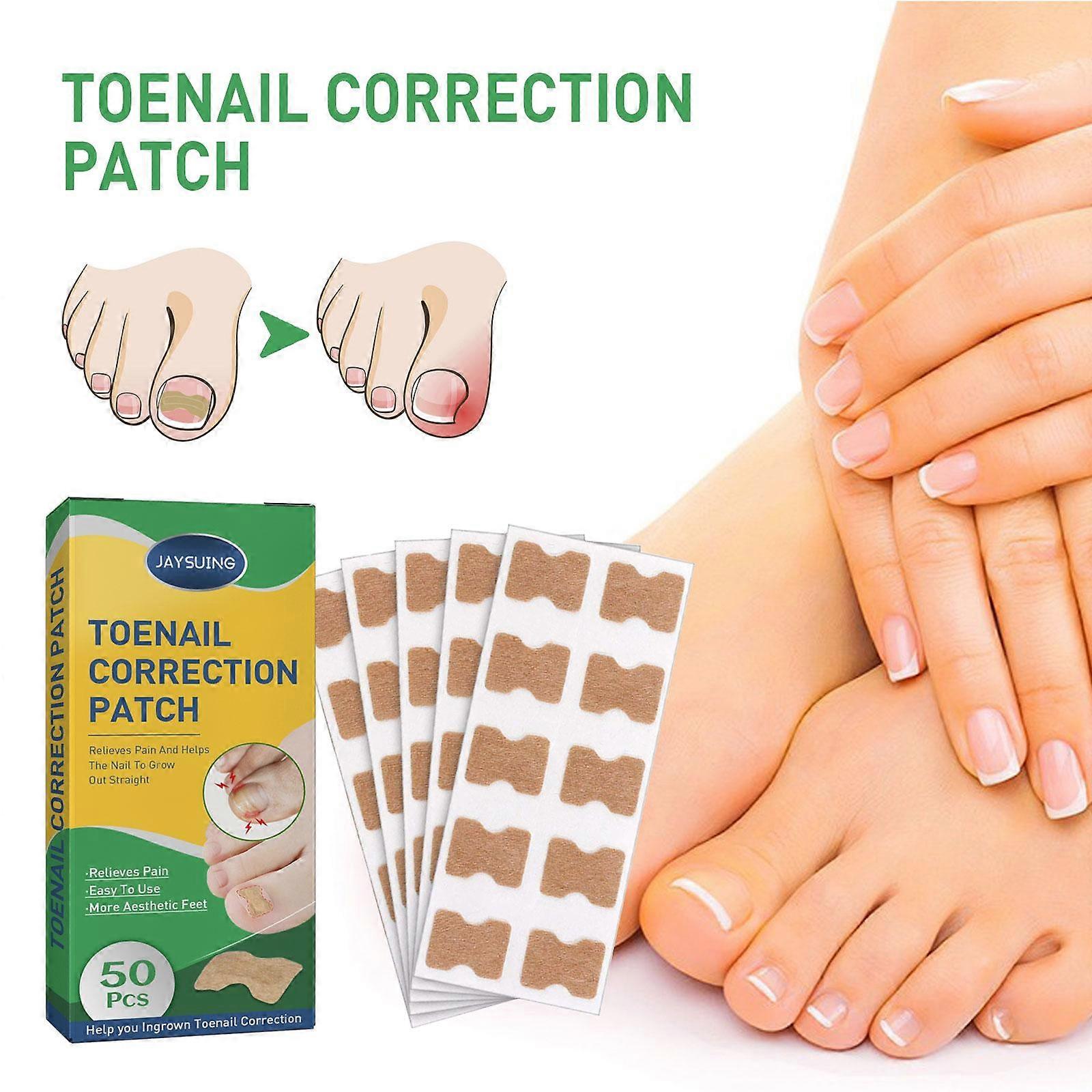 50pcs(A)$Ingrown nail correction stickers nail correction