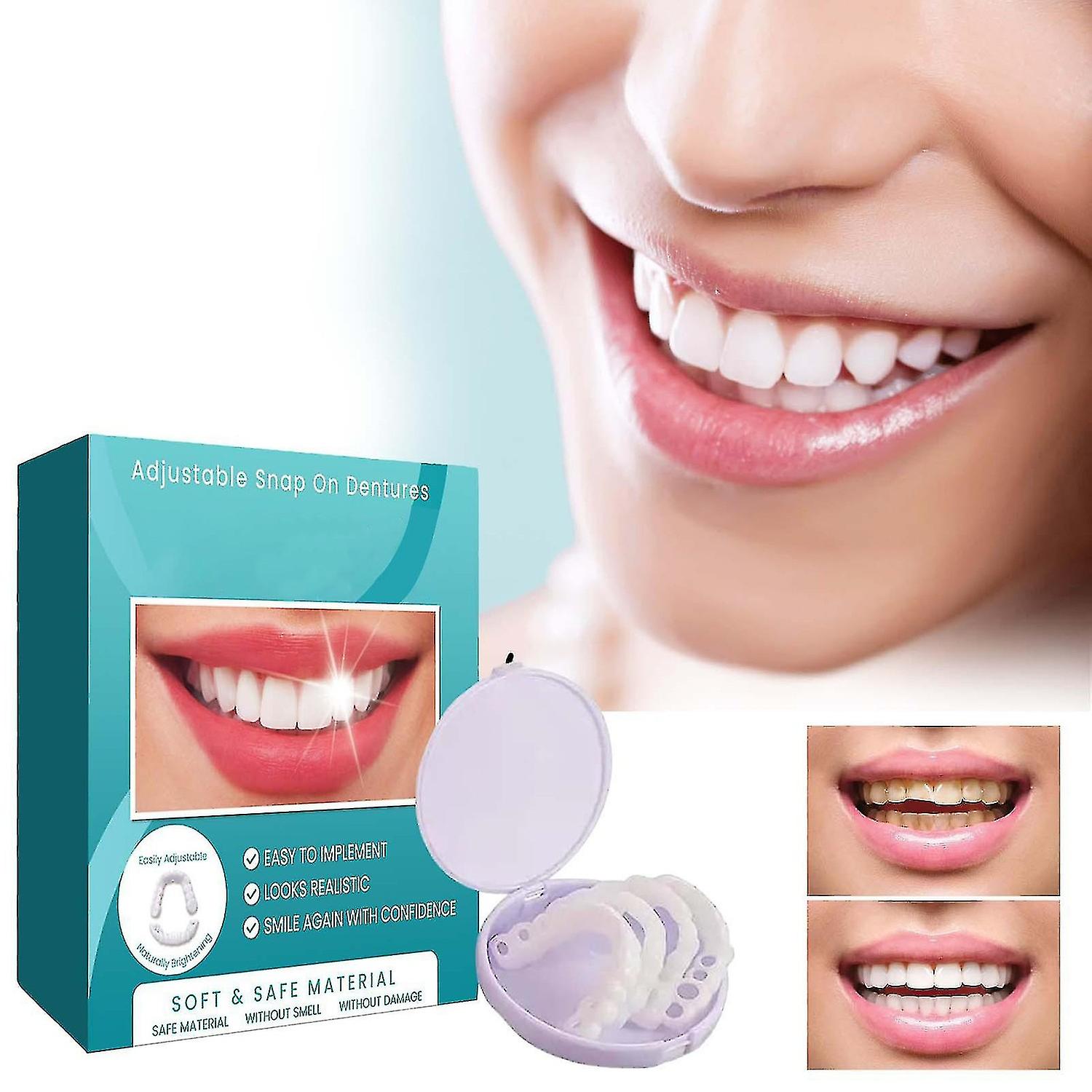 Adjustable Snap-on Dentures, Veneers Denture Braces Plus Denture Cases, Temporary Fillings Braces In