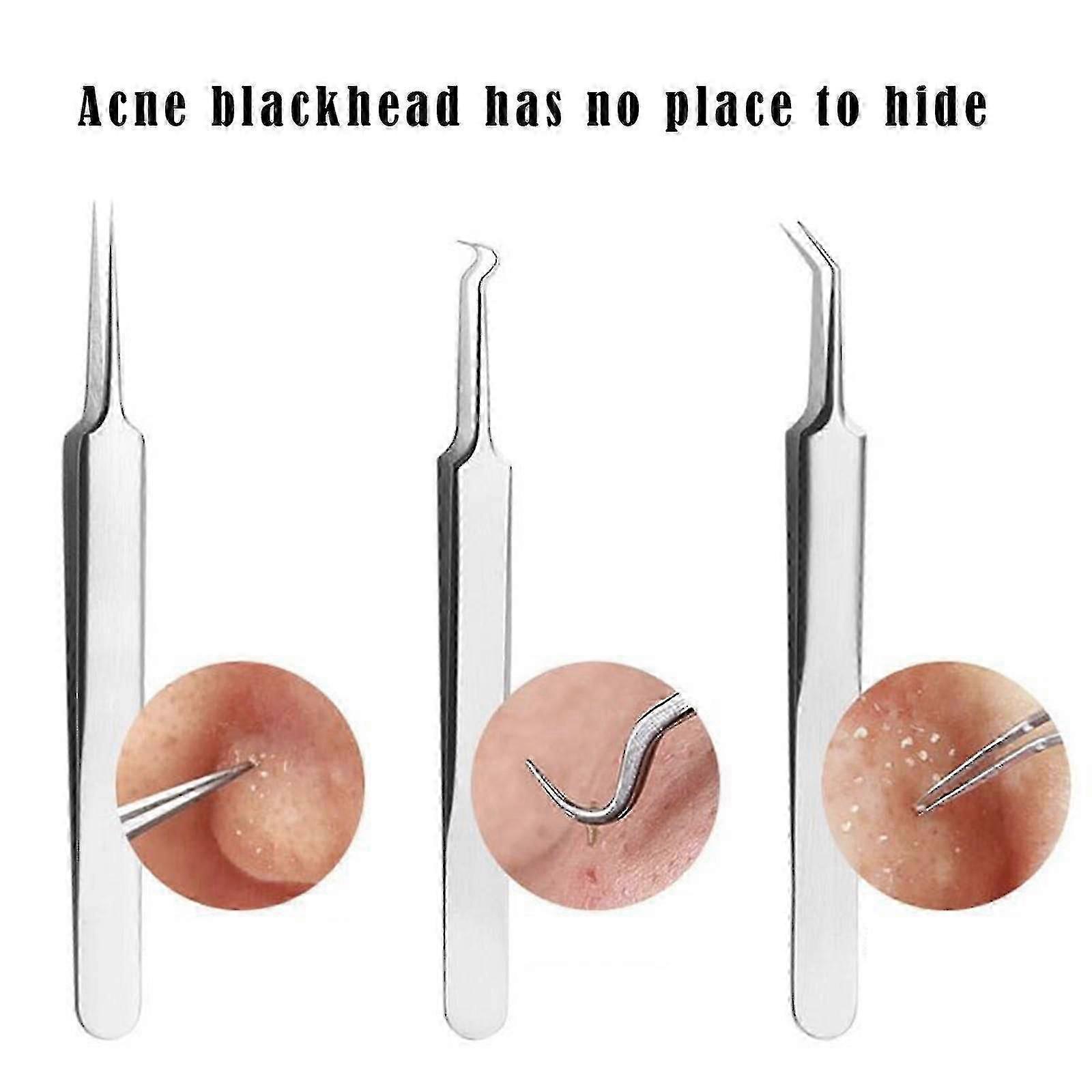 Blackhead Clip Needle Tweezers Pimple Extractor Remover 3 Types