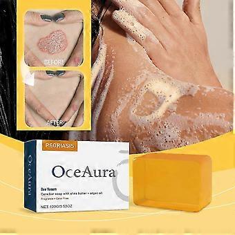 Sapone per il trattamento della psoriasi al veleno d'api, sapone per la cura della psoriasi al veleno d'api, sapone per la cura del veleno d'api con burro di karité e olio di argan