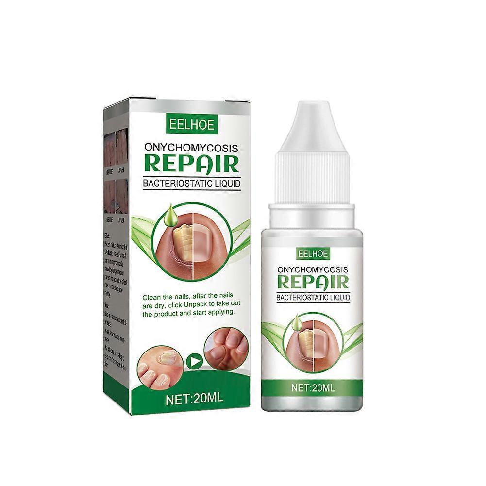 20ml נוזל פטרייתי לטיפול בציפורניים יעיל ביותר הורג פטרת ציפורניים תיקון