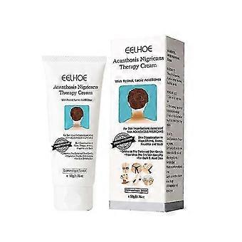 Acanthosis Nigricans Repair Cream 50g Acanthosis Nigricans Treatment Cream, Dark Spot Repair Cream