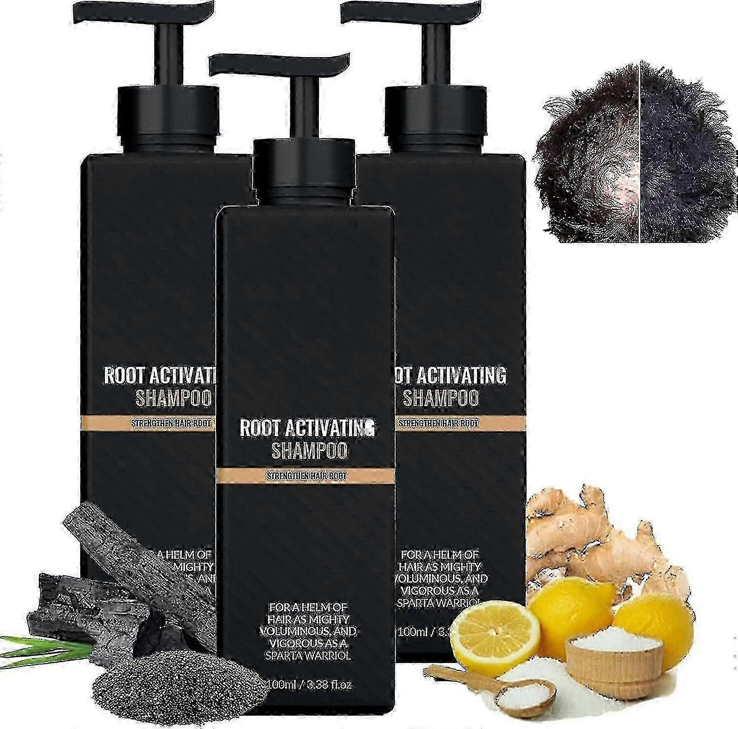 Root Activator Shampoo, Mane Root Activator Shampoo, Shampoo Root Activator Promotes Hair Growth For