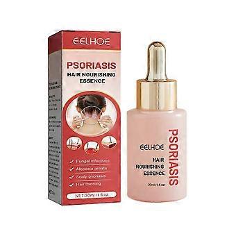 Moss Hair Nourishing Essence Tiefenreinigende Kopfhaut, Anti-Schuppen, Anti-Juckreiz und erfrischende Pflegelösung für dichtes Haar