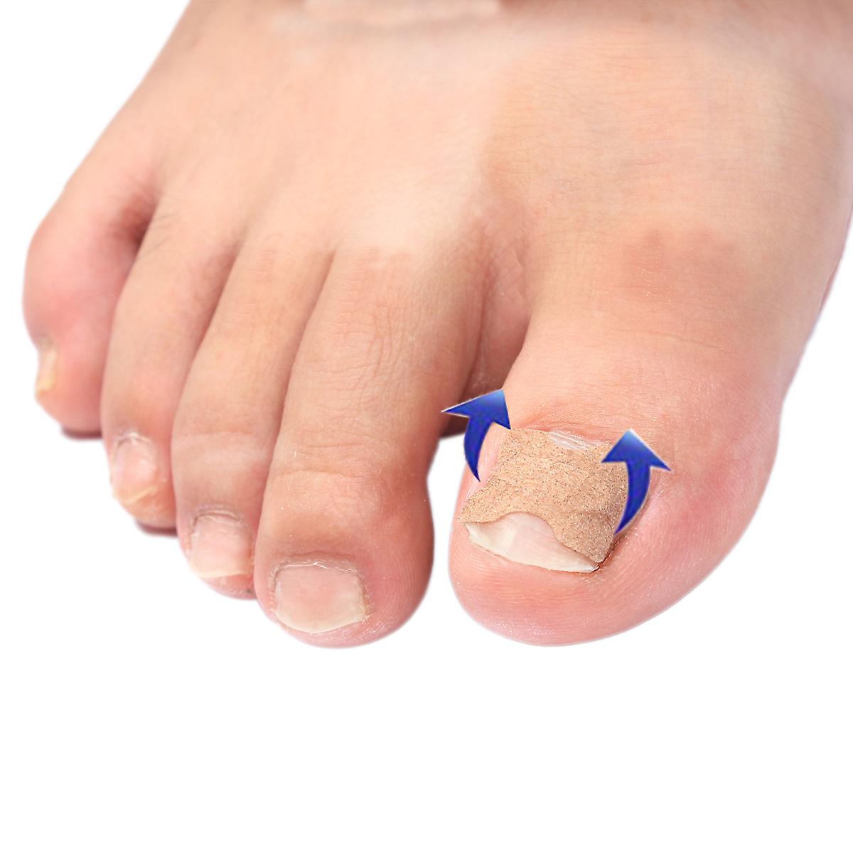 100pcs Toenail Correction Patch Glue Free Pedicure Tools Corrector Toe Nail Ingrown Patch