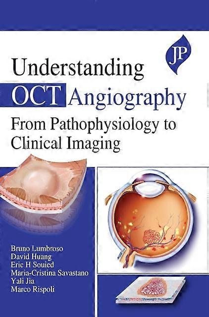 Understanding Oct Angiography by Marco Rispoli Hardback Book