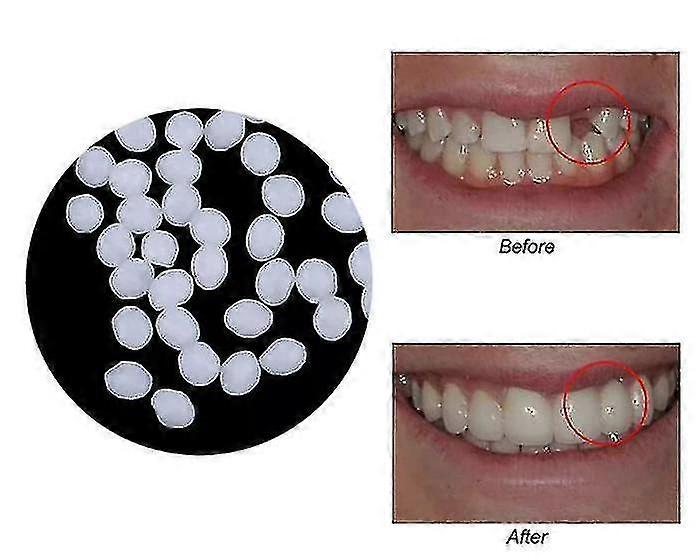 100g Teeth And Gap Falseteeth Solid Glue Resin Denture Adhesive