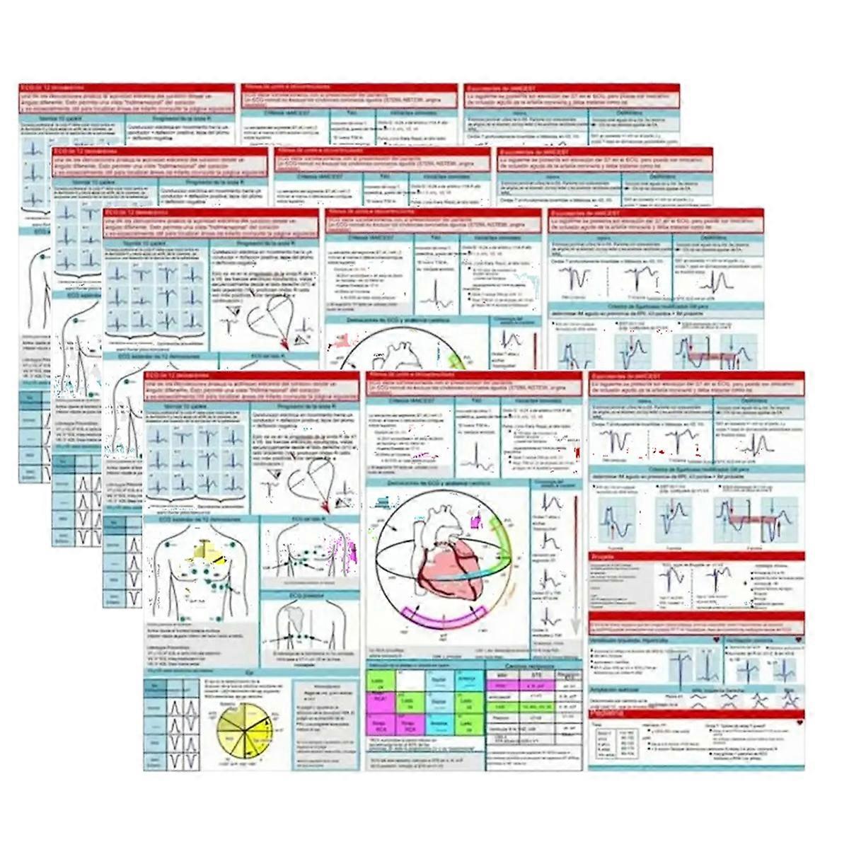 EKG Pocket Guide Ecg Interpretation Pocket Card Horizontal & Vertical Layout Compact Reference Guid