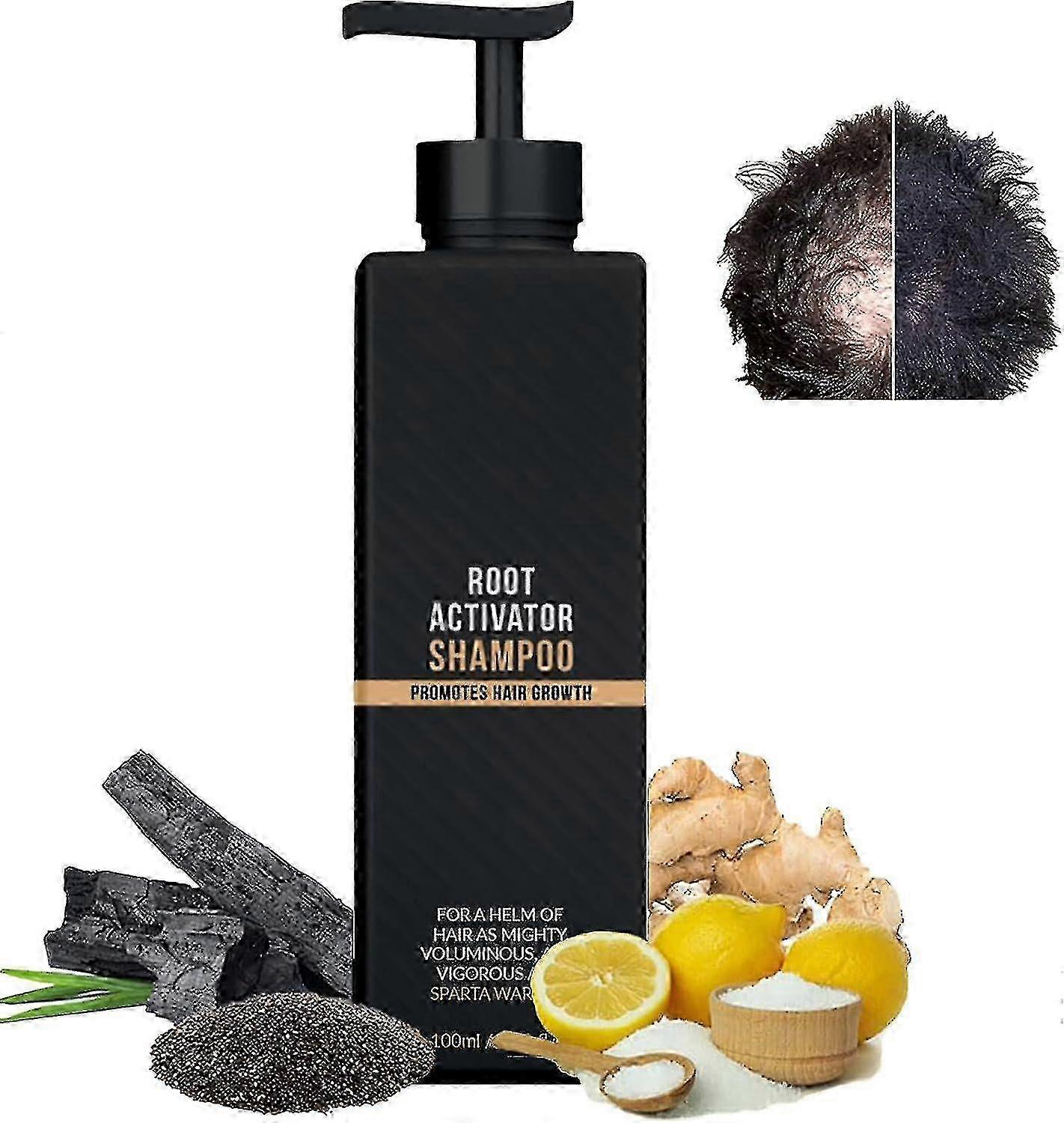 Root Shampoo Root Promotes For Men - Nniu1pcs Root Shampoo
