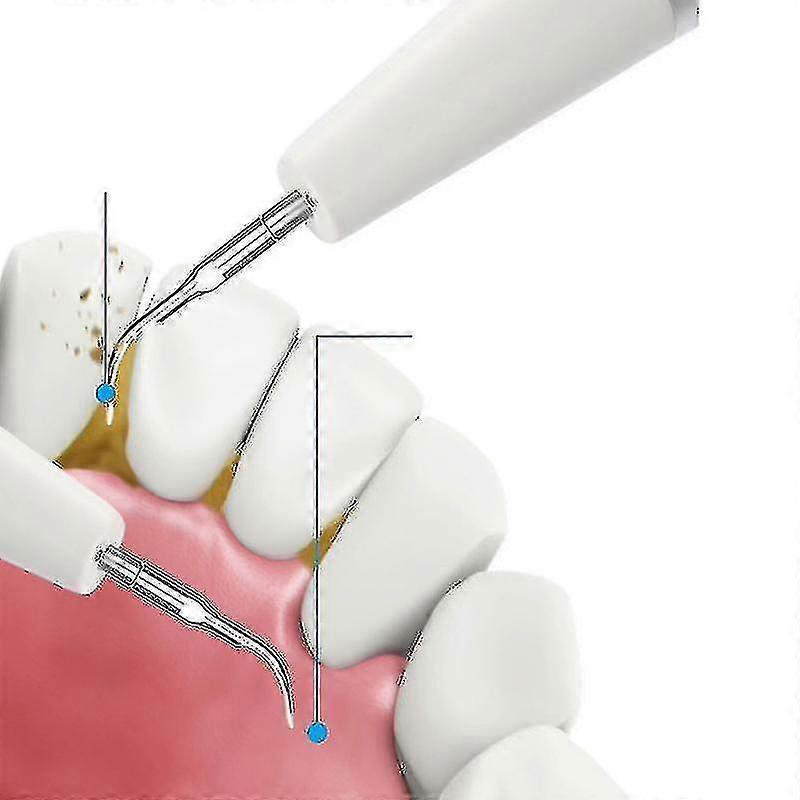 Ultrasonic Electric Calculus Remover Tartar Scaler Scraper Tooth Cleaner_L03