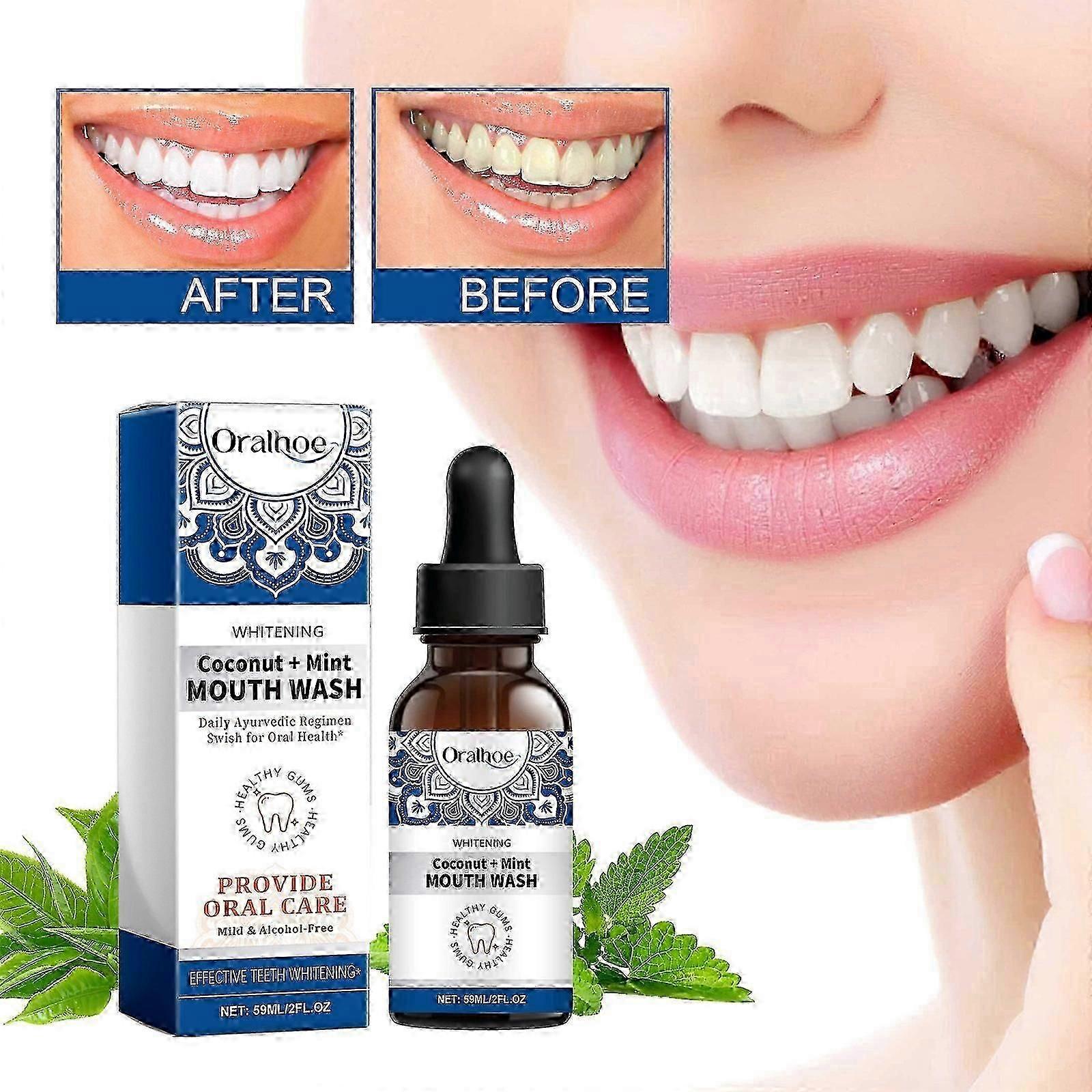 غسول الفم المركز ، قطرات غسول الفم بجوز الهند والنعناع ، خال من الفلورايد ، غسول الفم بالنعناع بالزيوت العطرية الطبيعية ، يدعم 300 شطف ، يساعد في زراعة جديدة
