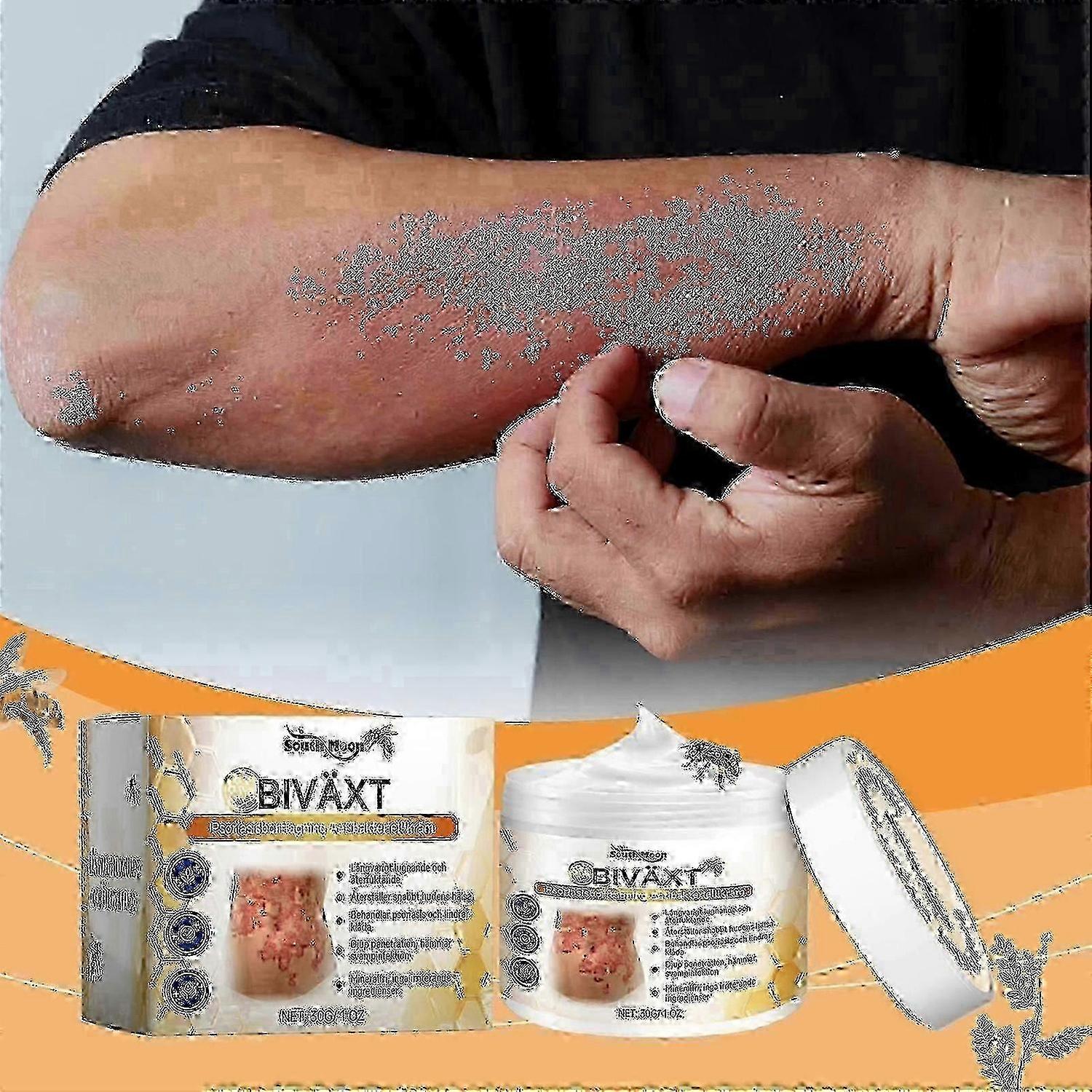 蜂毒乾癬クリームかゆみ止め皮膚緩和クリームスキンケア製品