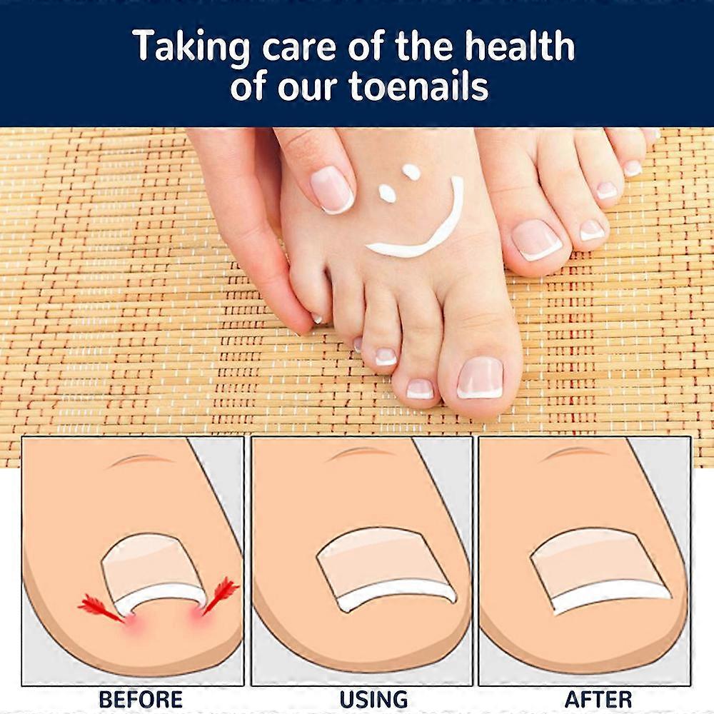 50 PCS Ingrown Toenail Correction Sticker Elastic Toenail Pedicure Tools