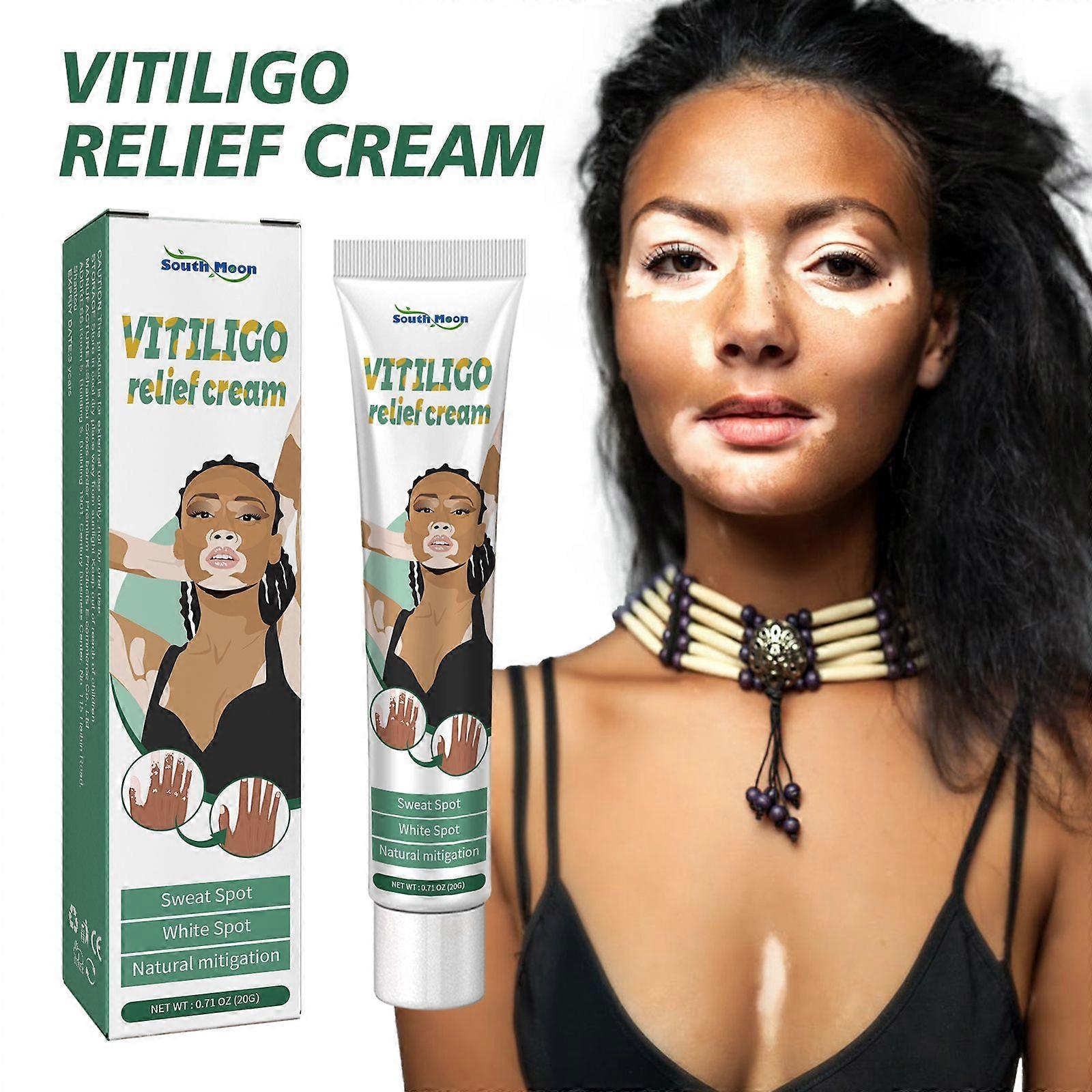 Vitiligo Relief Cream - Επανόρθωση Λευκών Κηλίδων &; Αποκατάσταση Χρώματος Δέρματος με Σαφράν &; Brucea