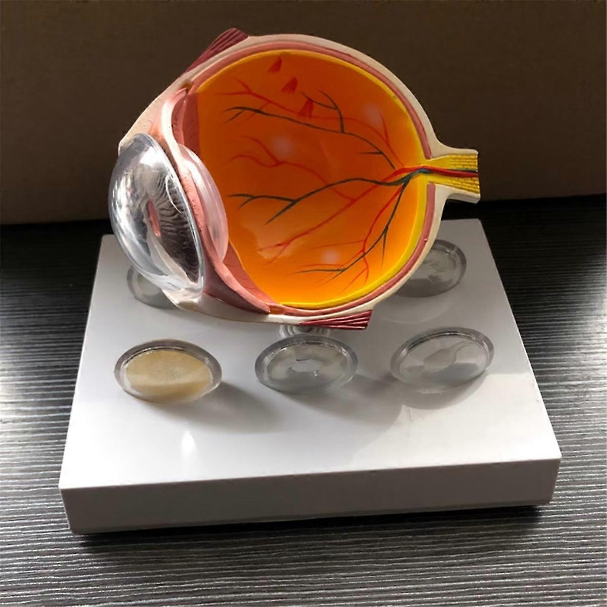 Eyeball Model Human Eye Demonstration Glaucoma Cataract Anatomy