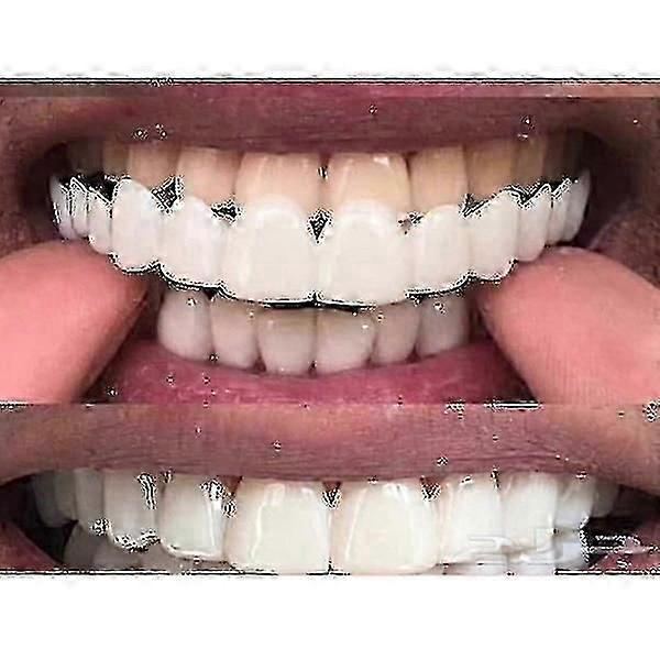 Upper/lower  Comfort Fit Flex Whitening Denture Braces-MXBC