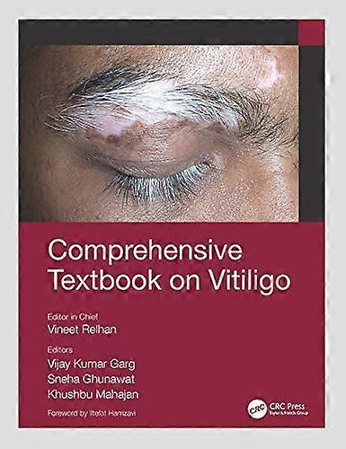 Comprehensive Textbook on Vitiligo