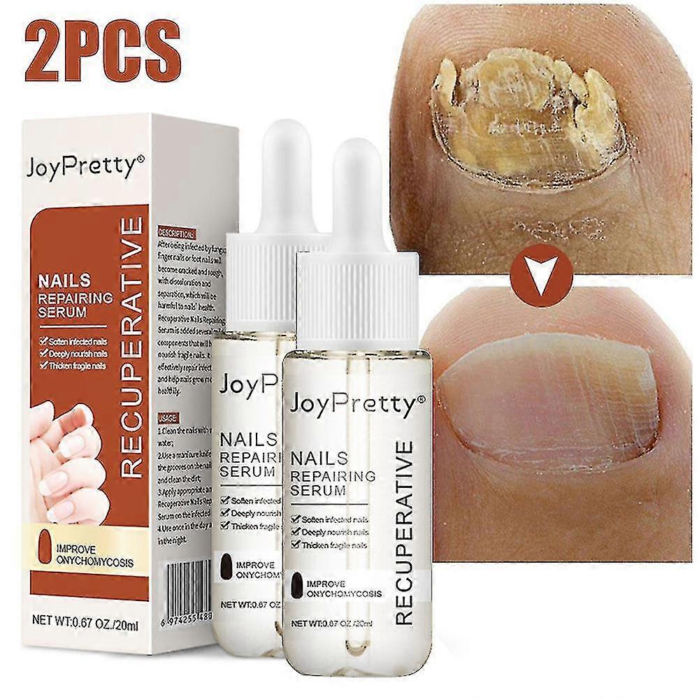 菌類ネイルケアセラムシックネイルソフトネイルリペアエッセンスローションつま先ホワイトニングトリートメントケアTW