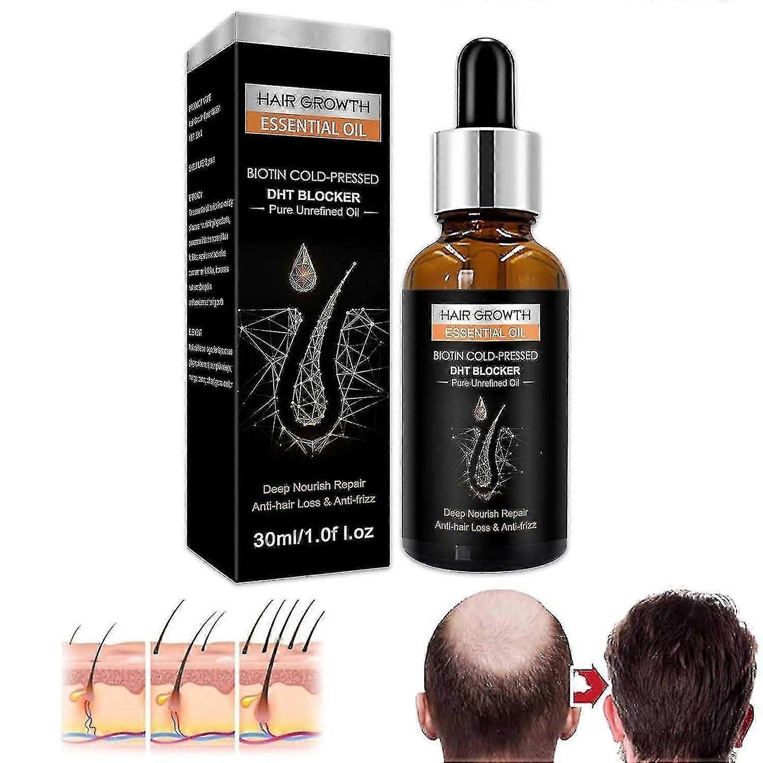 Olio di zenzero, olio per uomini e donne, per diradare