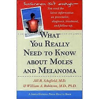 What You Really Need to Know about Moles and Melanoma