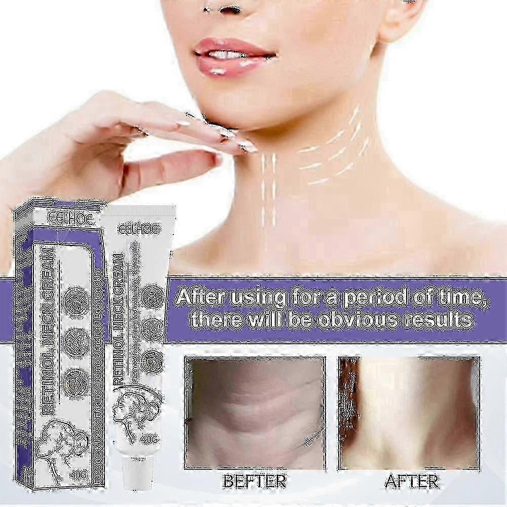 1 قطعة كريم الرقبة الريتينول لمكافحة الشيخوخة لشد البشرة تبييض البشرة ومكافحة التجاعيد كريم -