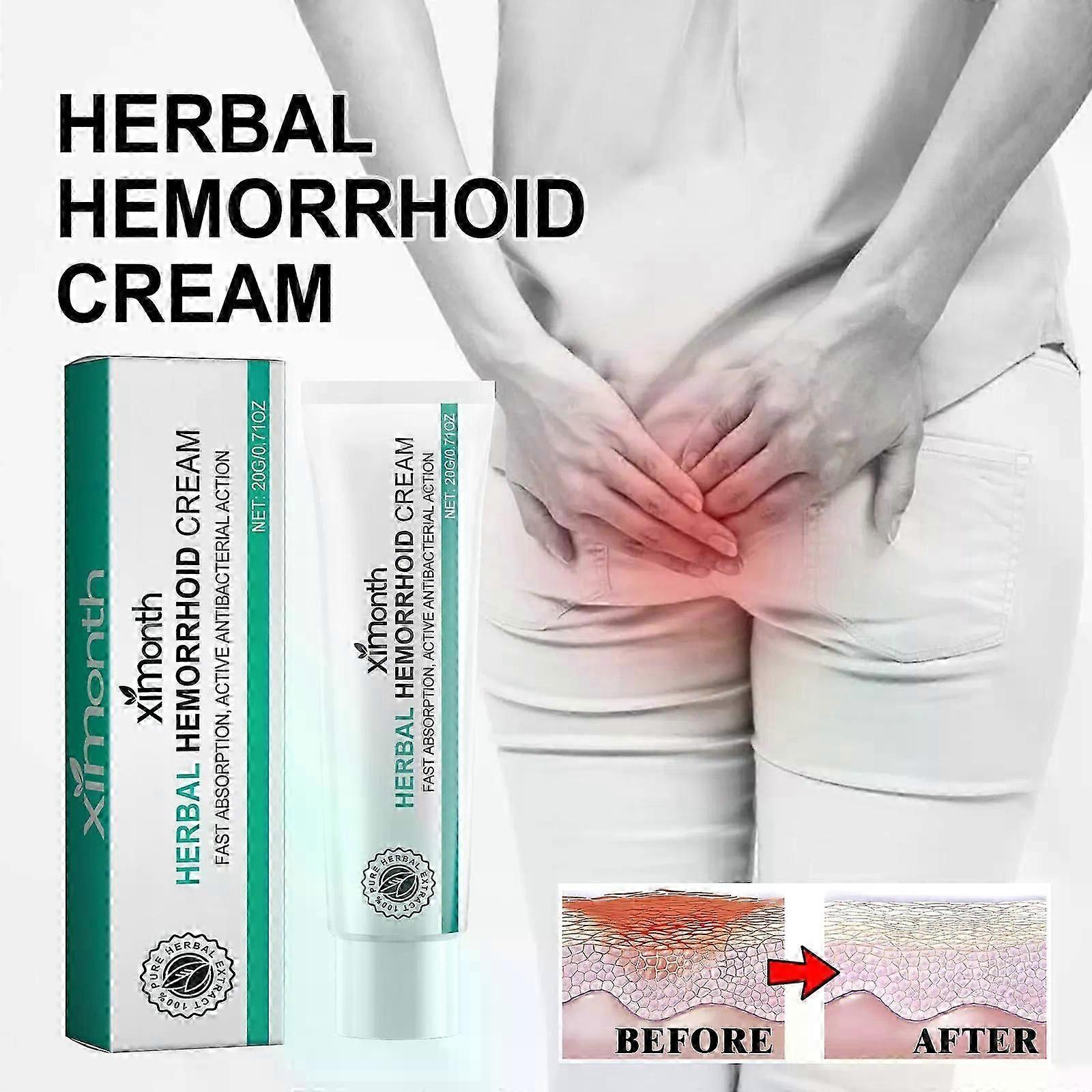 كريم البواسير للرجال والنساء ، العلاج بالأعشاب ، 1-3 قطع