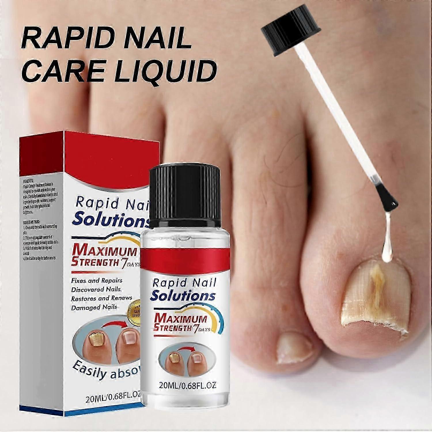 ネイルリペアオイル、成長のためのネイルリペアリキッド、マイルドキューティクルコンディショナー、ネイル用ネイル強化剤、子供、大人