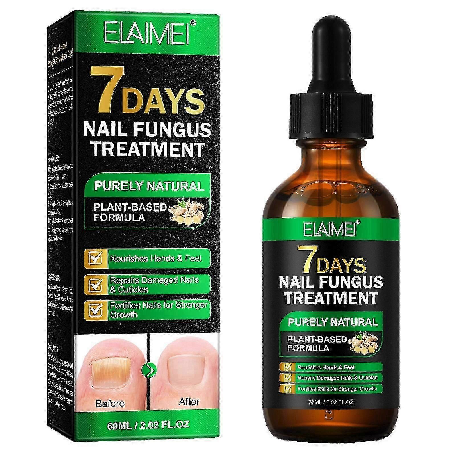 Tånagelsvamp Nagelbehandling Extra stark ingefära nagelbehandling Nagelstöd Nagelvård, Nagelbehandling, Nagelstärkande ingefära nageltillväxtserum