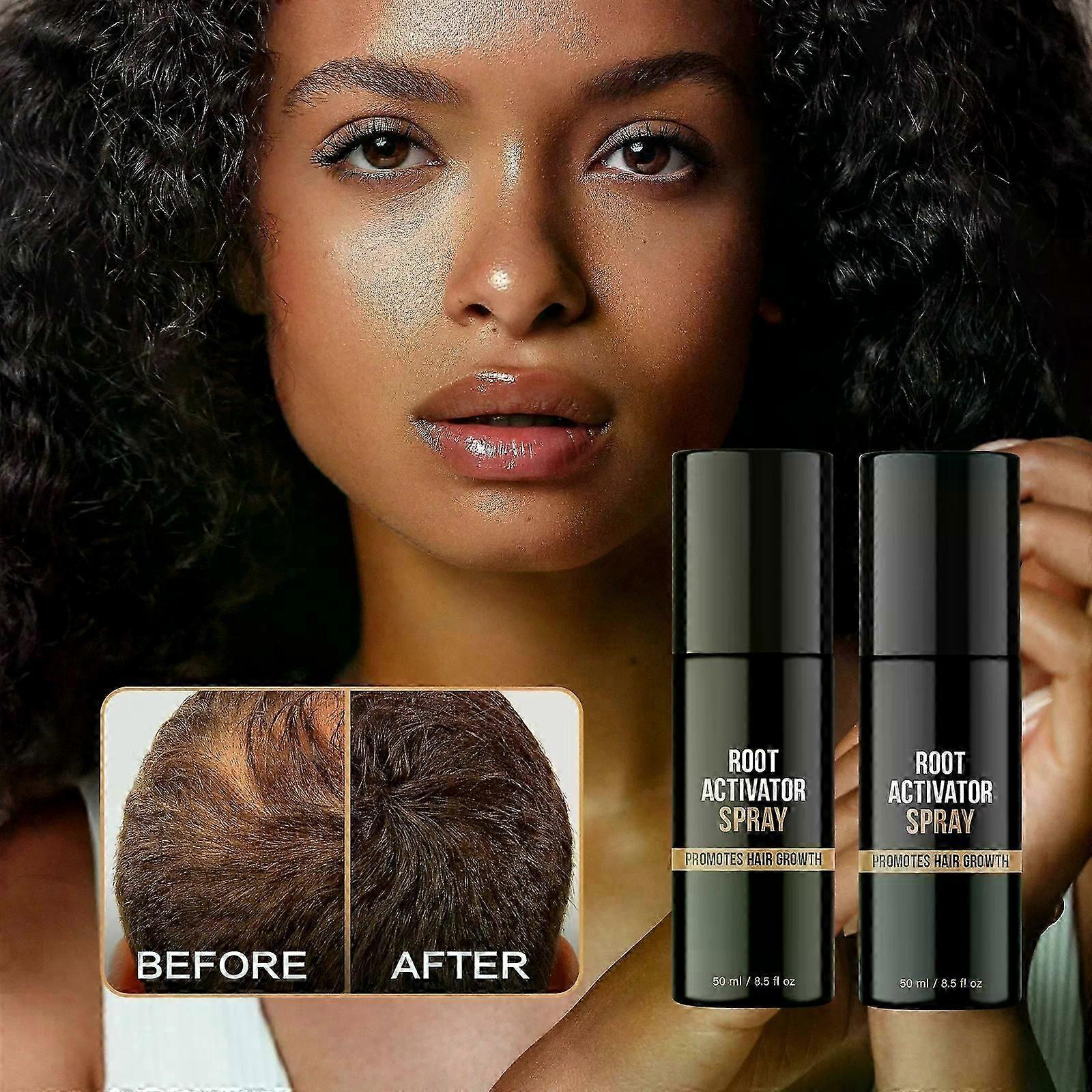 بخاخ منشط الجذر ، رذاذ منع تساقط الشعر ، رذاذ سماكة الشعر ، بخاخ إعادة نمو الشعر الطبيعي للرجال والنساء