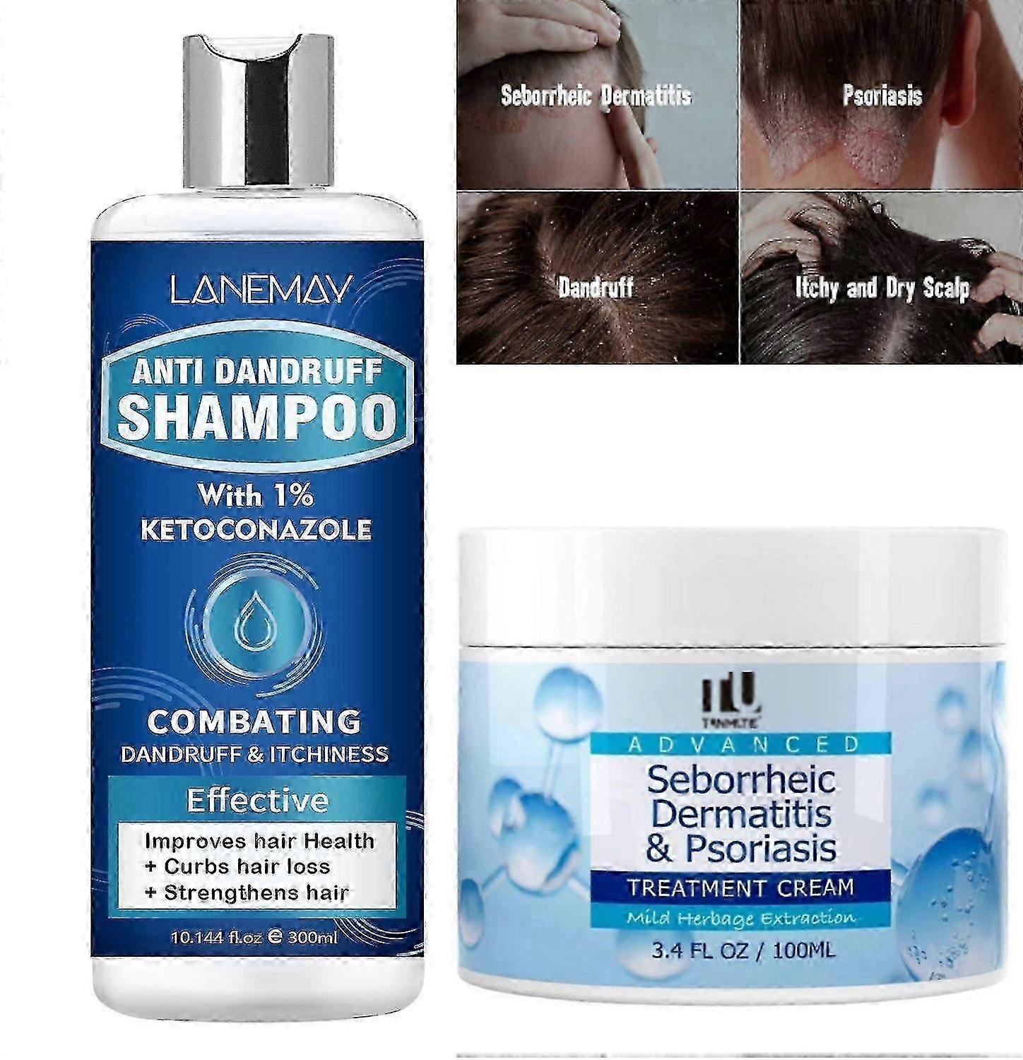 Anti Dandruff Shampoo & Seborrheic Dermatitis Cream Set, Scalp Treatment for Psoriasis, Folliculitis, Scalp Itchness Relief, Sooth, 300ML Anti Fungal