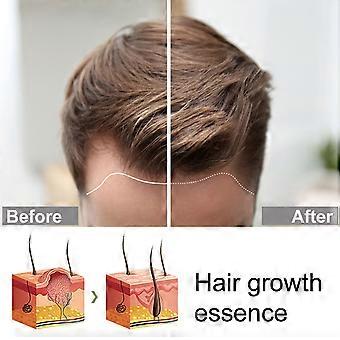 Gember haargroei-essence versterkt en herstelt haarwortels, haarverzorging tegen haaruitval, vloeistof 30 ml
