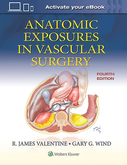 Anatomic Exposures In Vascular Surgery by Gary G. Wind Paperback Book