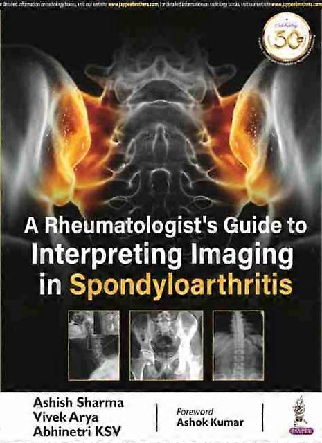 A Rheumatologists Guide To Interpreting Imaging In Spondyloarthritis by Ashish Sharma Paperback Book