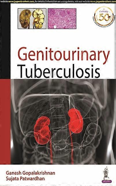 Genitourinary Tuberculosis by Ganesh Gopalakrishnan Paperback Book