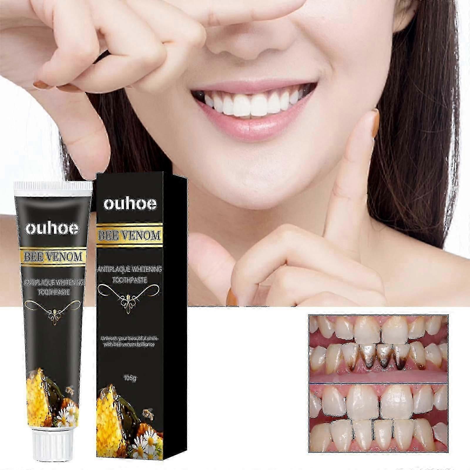 يعتني معجون الأسنان المبيض OUHOE باللثة ، وينظف البقع ، والأصفر والجير ، ويزيل رائحة الفم و w