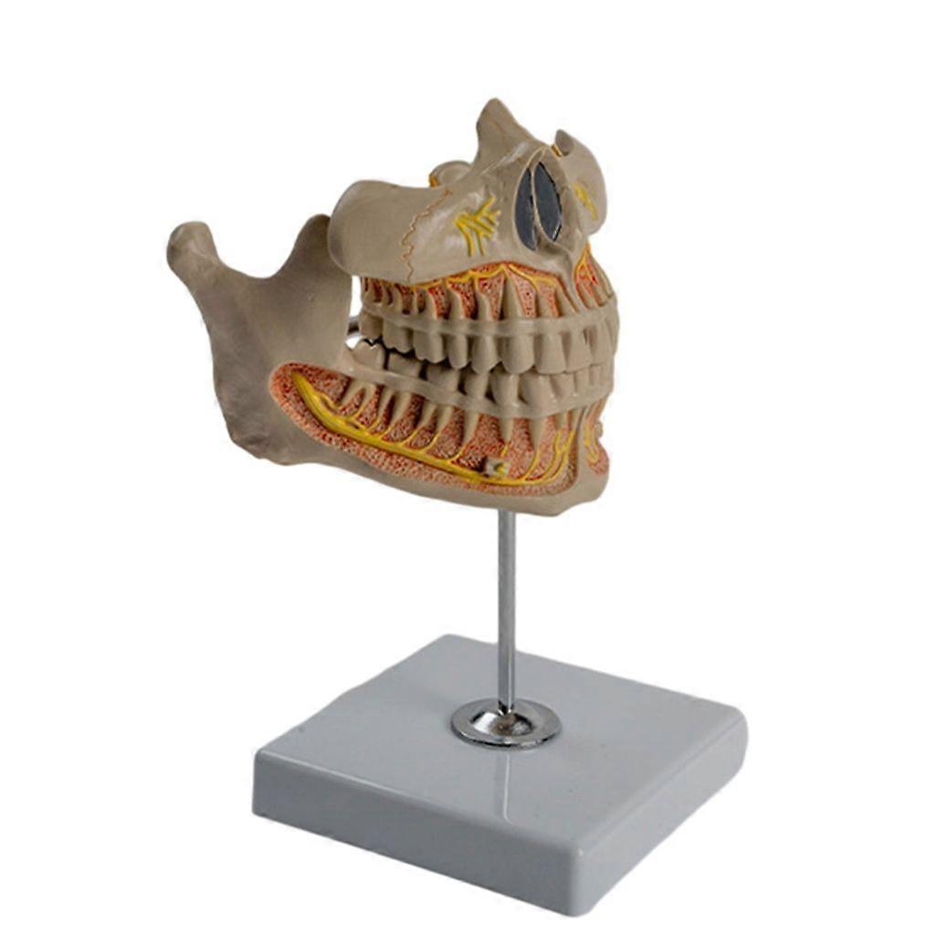 Human Teeth Model Shows Permanent Tooth, Gingiva