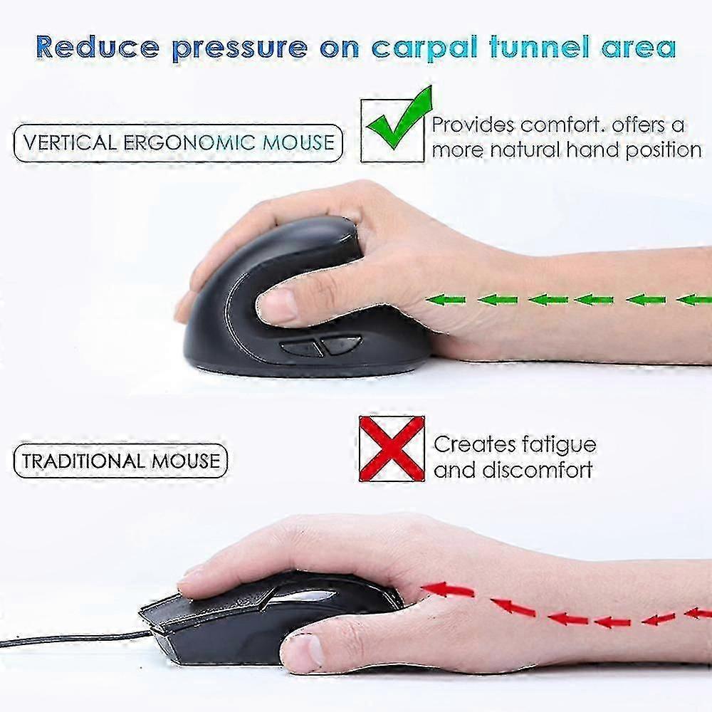 2.4g Wireless Mouse Ergonomic Mouse Computer Office Vertical Grip Mouse Noiseless Mouse For Compute