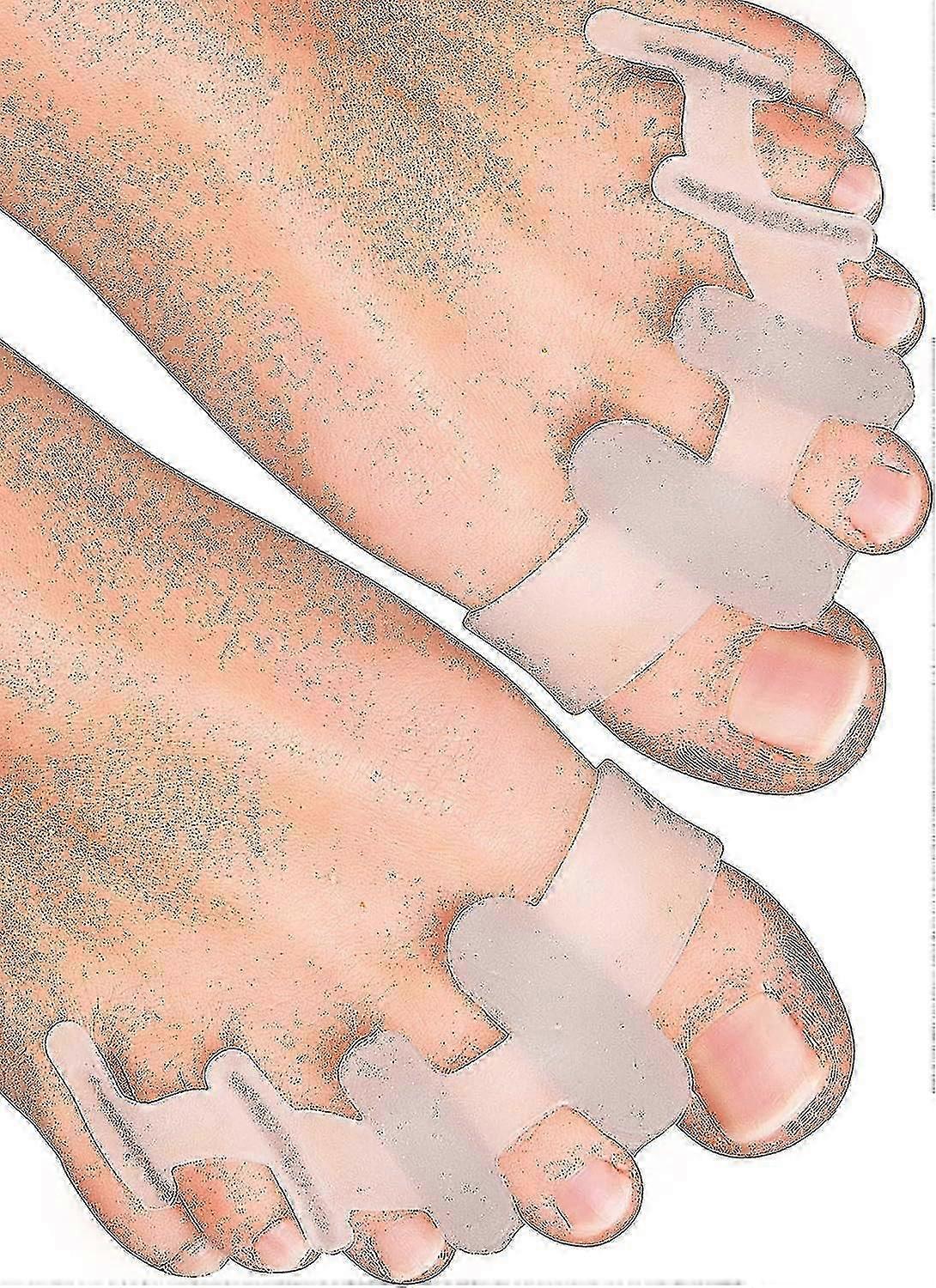 Yogamedic Toe Separator For Overlapping Toes 6pcs Improved Silicone, 0% Bpa, Onesize Bunion Corrector Toe Straightener To Relax, Spread And Stretch -
