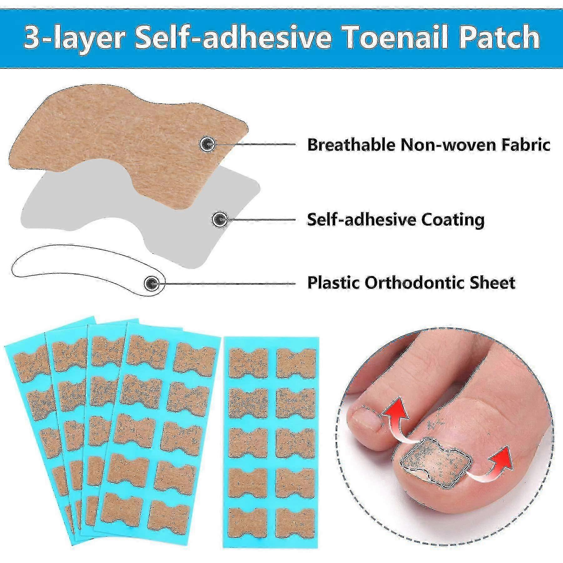 Lepidlo bez nehtů Toe Ingrown Nail Correction Patch Nail Sticker Professional