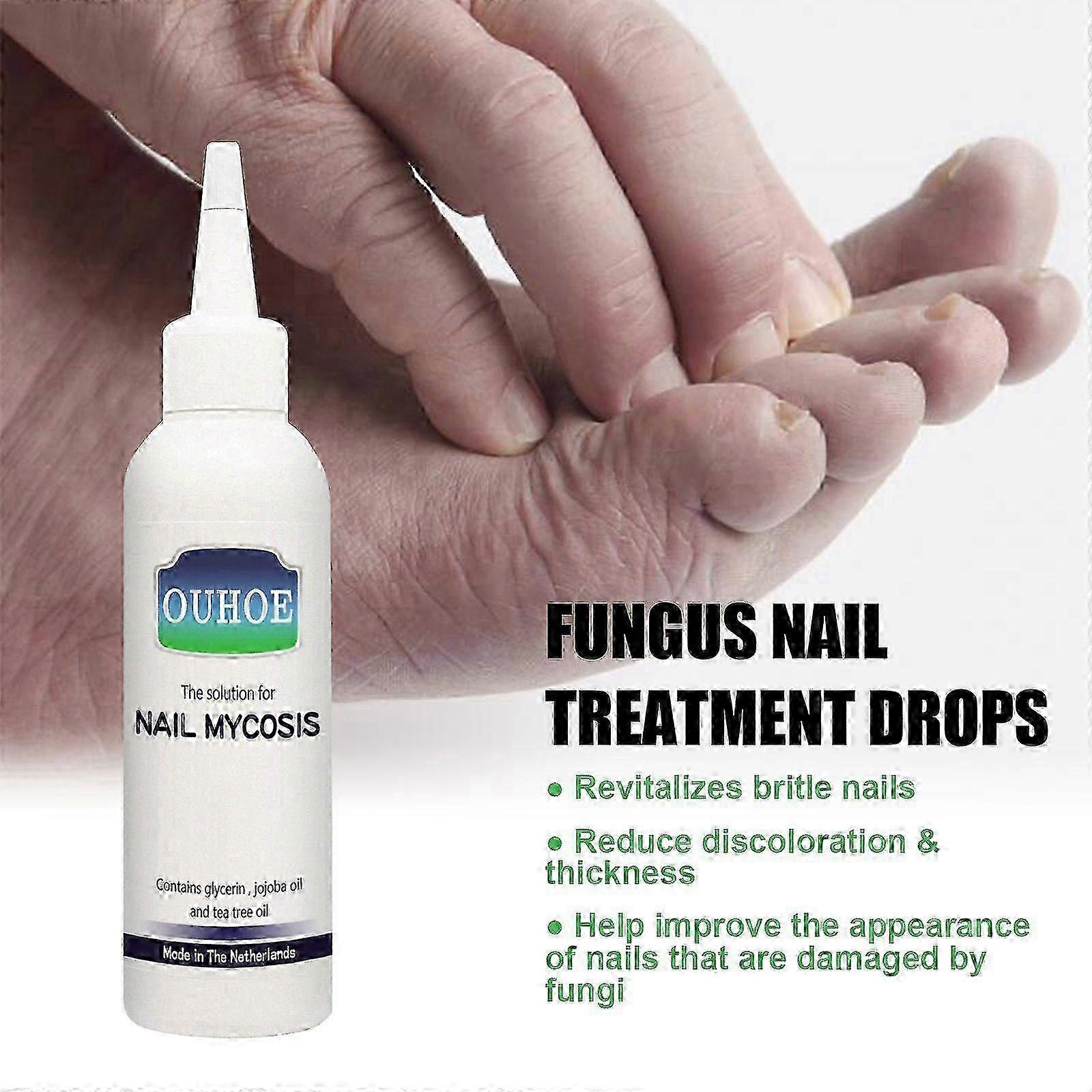 Gray Nail Repair Drops